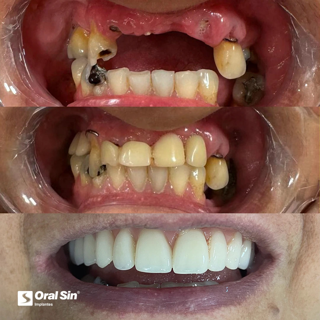 Paciente real — antes e depois 5