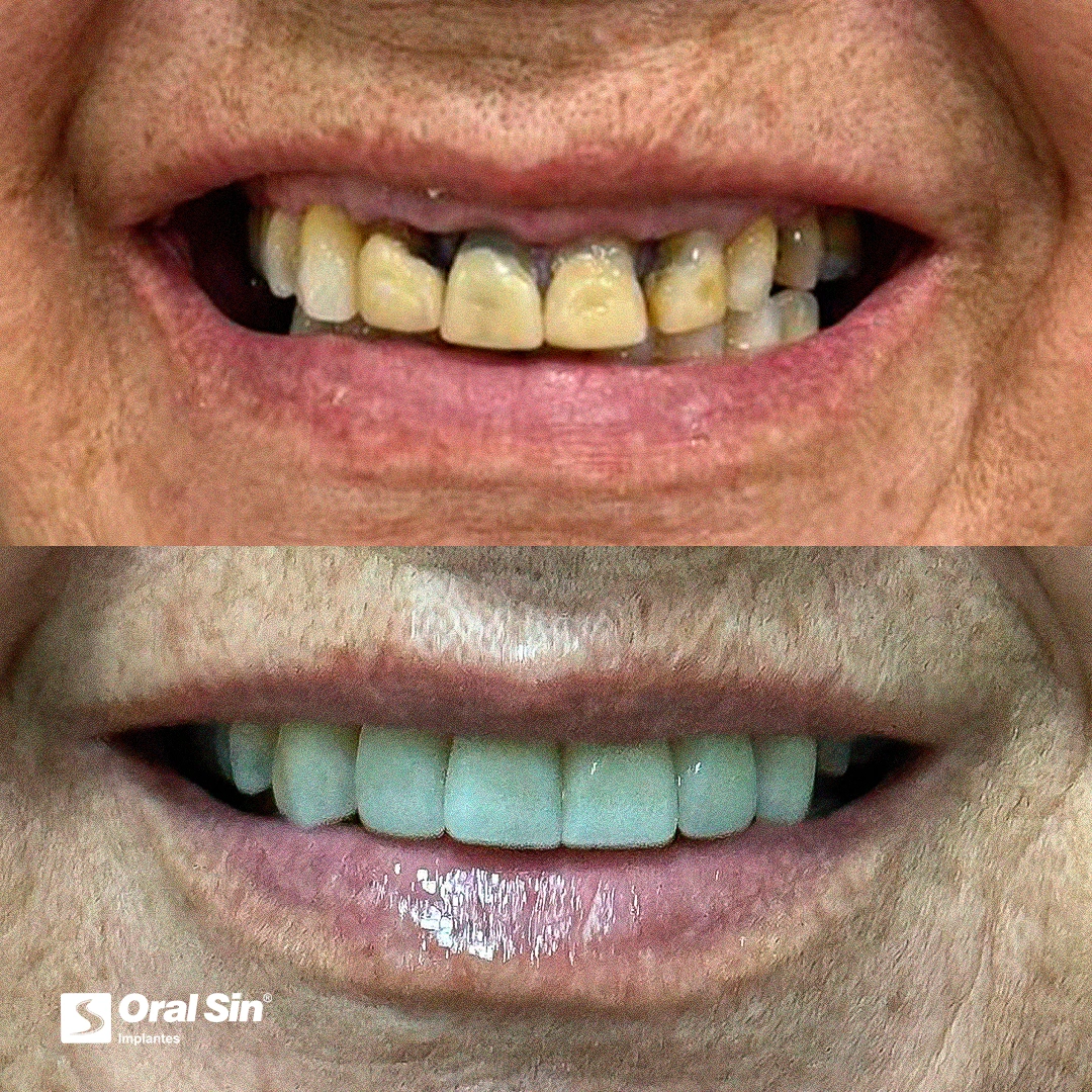 Paciente real — antes e depois 7