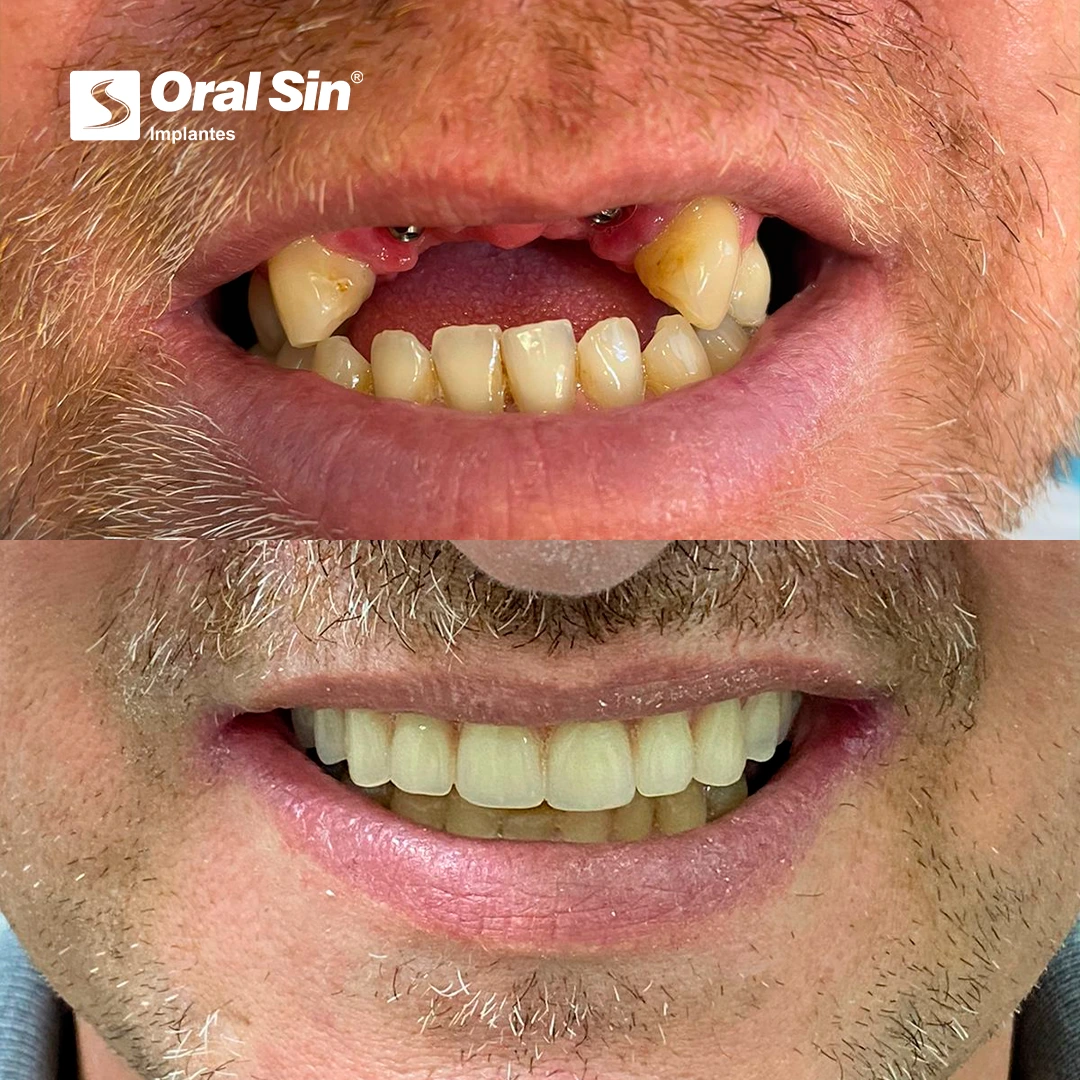 Paciente real — antes e depois 8